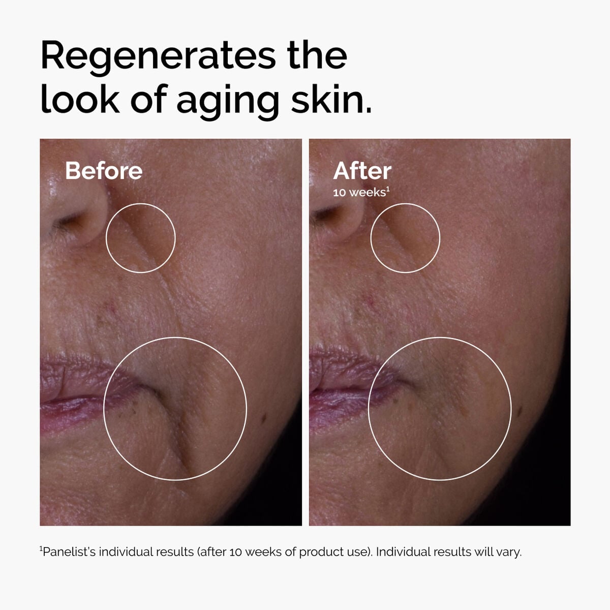 GF 15% Solution Targeted Serum Care