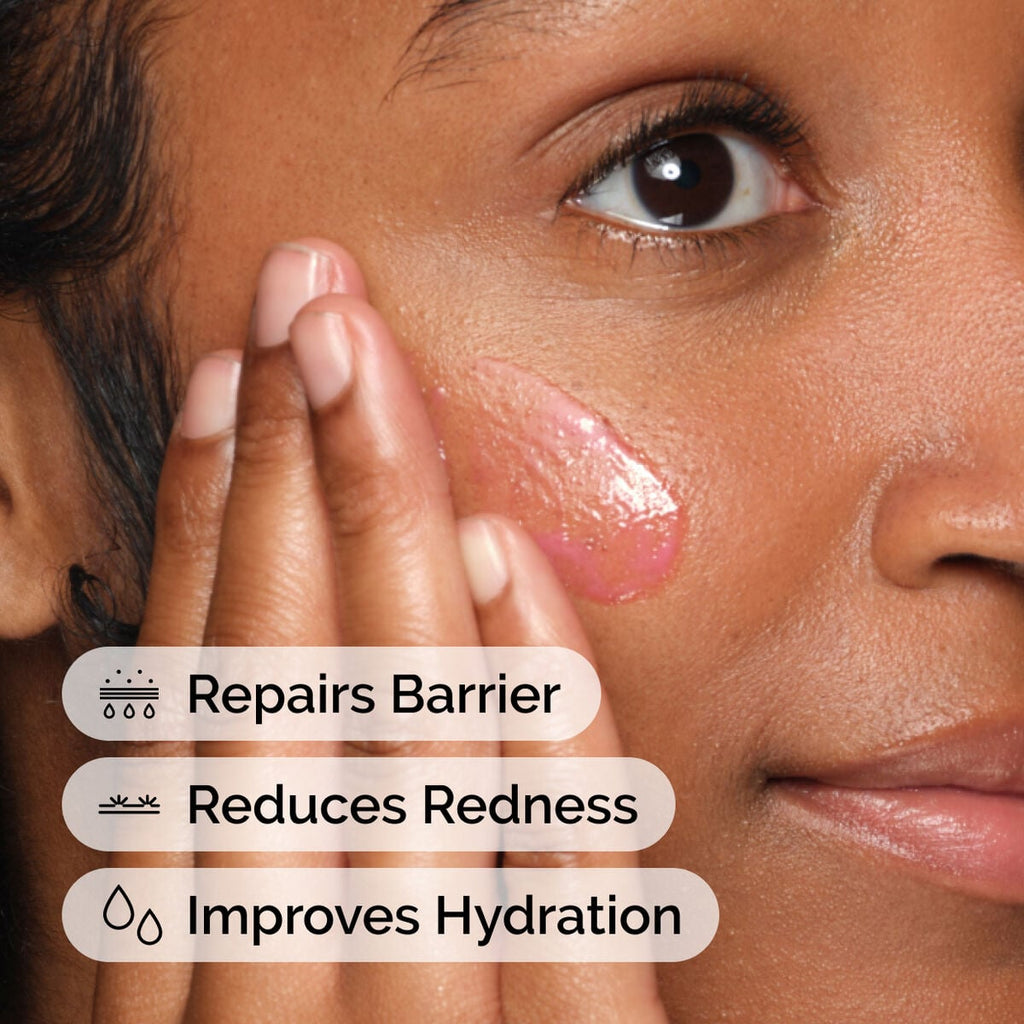 Soothing & Barrier Support Serum Targeted Serum Care